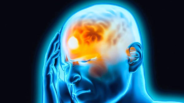 মাইগ্রেনের চিকিৎসা করবেন কীভাবে?