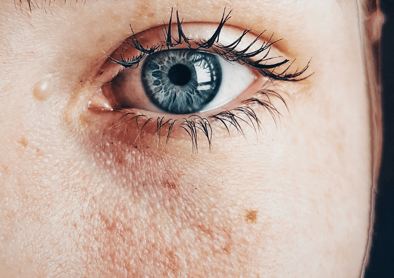 শীতে ত্বকের শুষ্কতা দূর করার সহজ উপায়!