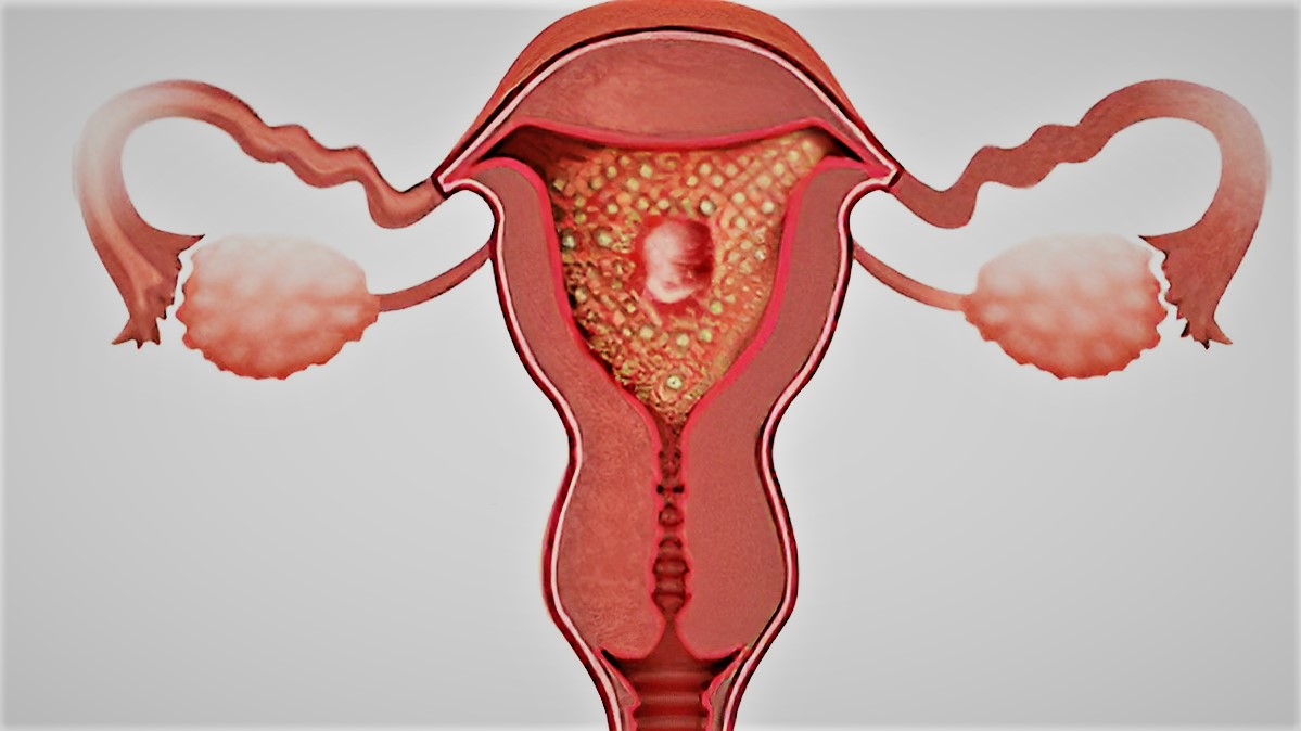 মোলার প্রেগন্যান্সি কেন হয়? কেন আক্রান্ত মায়েরা ক্যান্সারের ঝুঁকিতে থাকেন?